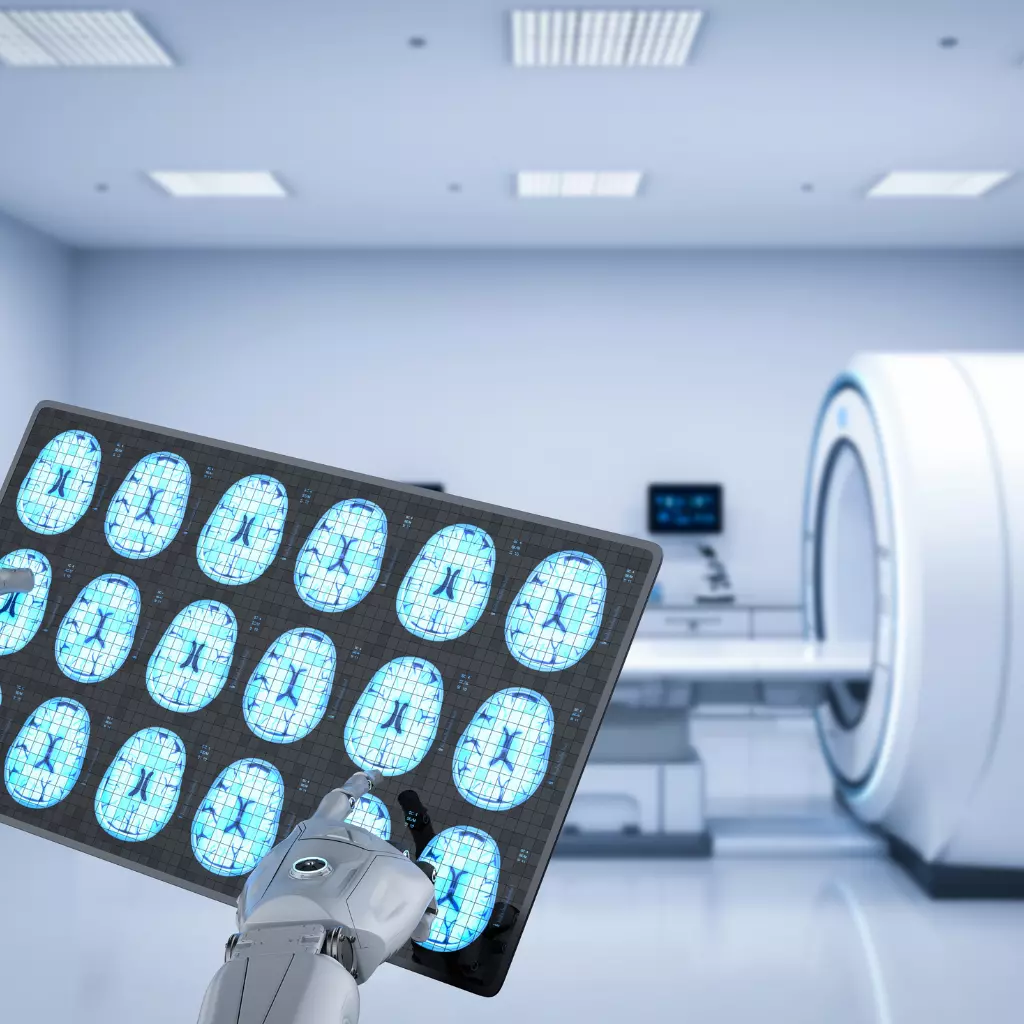 AI in radiology